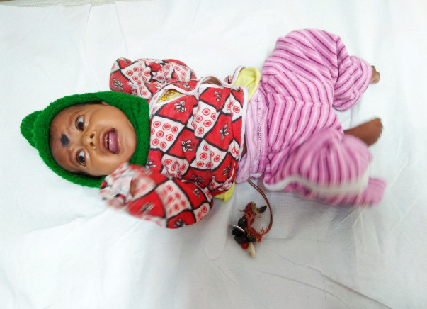 Help Baby Rinku Undergo A Heart Surgery