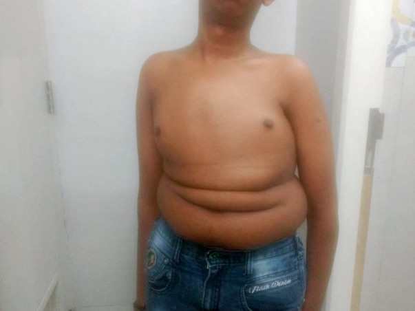 Help Shiva Fight His Spinal Cord Problem