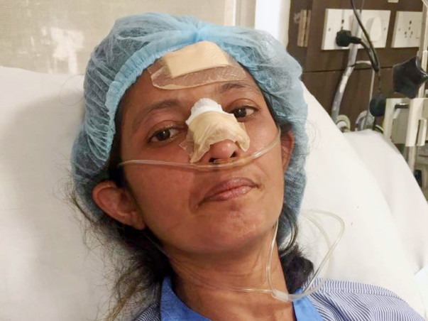 Help Dipti Joshi Fight Scleroderma