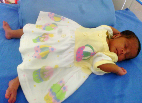 Please help treat Alagu's premature baby daughter