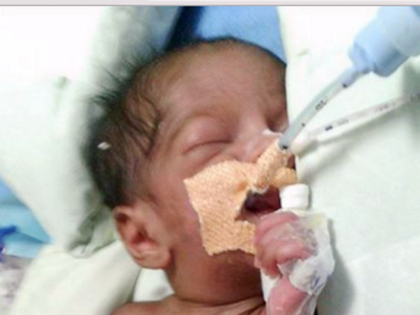 I am fundraising to Help Baby Vanshu get off the ventilator