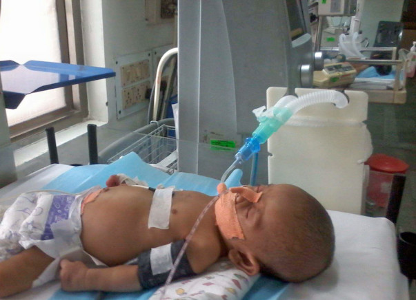 Help save baby Ghansham who's fighting against Shock& respiratory fail