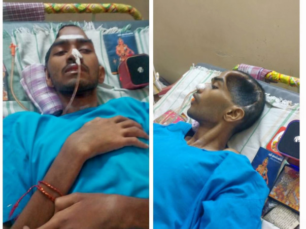Help Manikandan Who Is Fighting For His Life From A Gory Accident