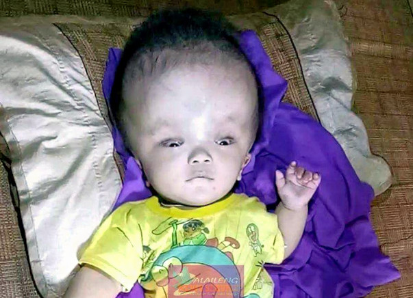 Mimin's Head Will Explode If You Don't Help Him