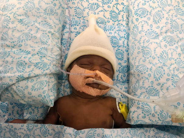 Help Mr & Mrs. Shobarani To Save Their Only Surviving Twin