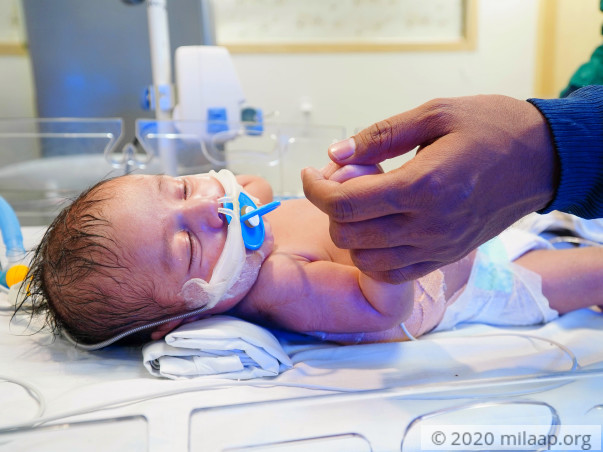 Baby of Madhu Sharma needs your help to survive