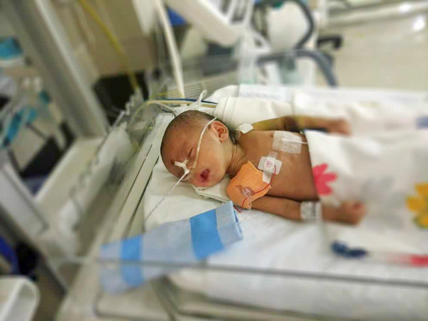 Help 3-month-old Manak fight heart disease