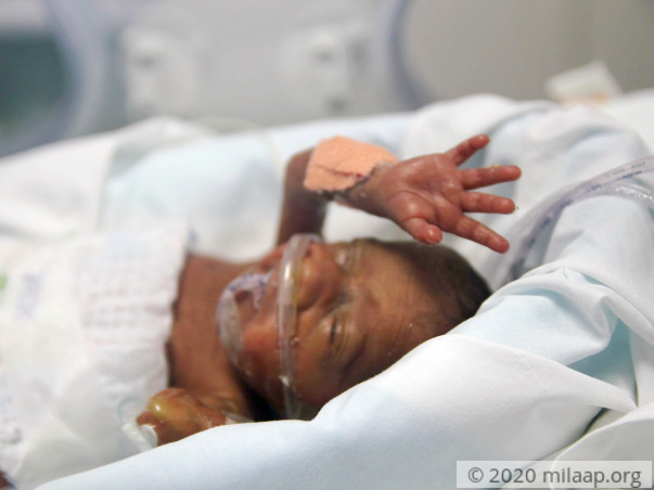 Help Sarmistha Save Her Premature Twin Babies