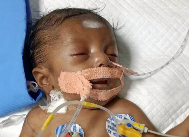 Save Baby Chandresh