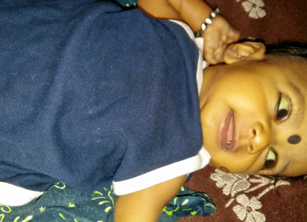 5-month old Baby Nainitha Needs To Undergo Liver Transplant