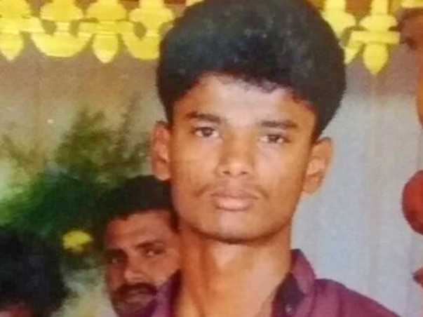 Help Hariprasath Skull Operation