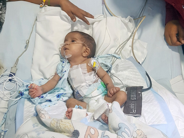 Help Baby Harshit Fight Congenital Heart Disease