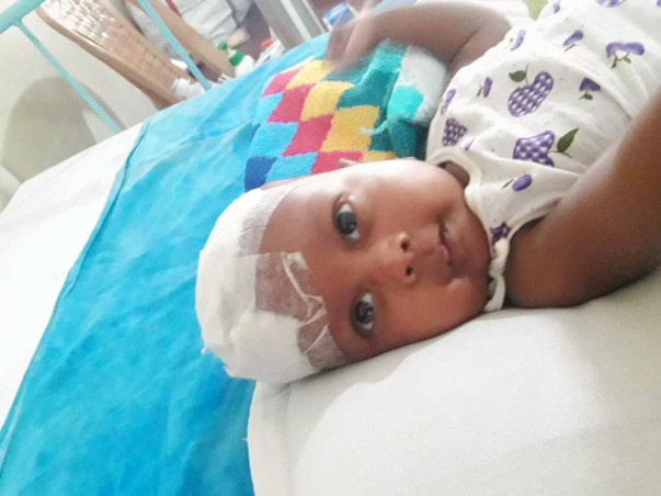 2 months old ARUSH DEY needs your help fight Right fronto-parietal space occupying lesion