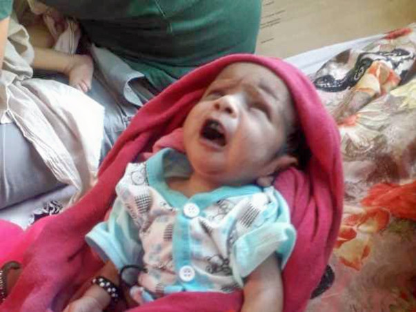 Help Baby Aarohi Undergo Open Heart Surgery