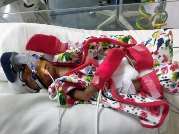 Help New Born Baby Fight A Respiratory Infection