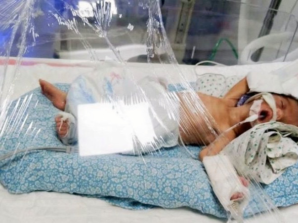 Help My Daughter Recover From Preterm Birth