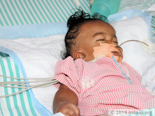 9-months old baby of Suma needs your help for his treatment