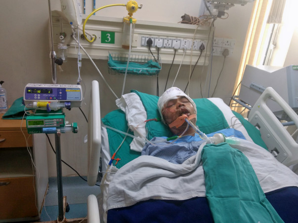 Help My Best Friend Recover From A Terrible Road Accident