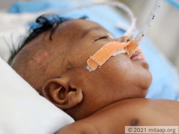 Peon Struggles To Save 1-Month-Old Baby Girl From Bacterial Infection