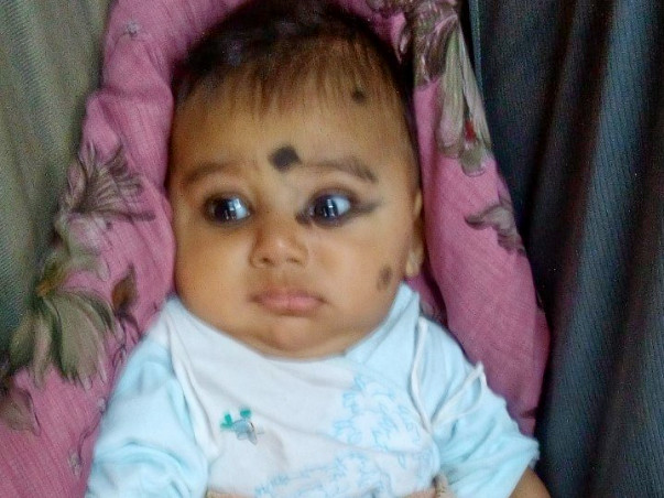 This 4-month-old Baby Is Fighting Cancer Of Nerve Cells To Stay Alive