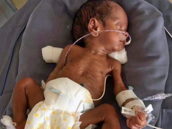 These Parents Need Your Help To Save Their Prematurely Born Baby Boy