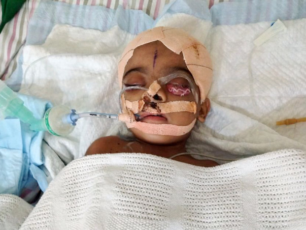 Help Fatima who is on the verge of completely losing her vision