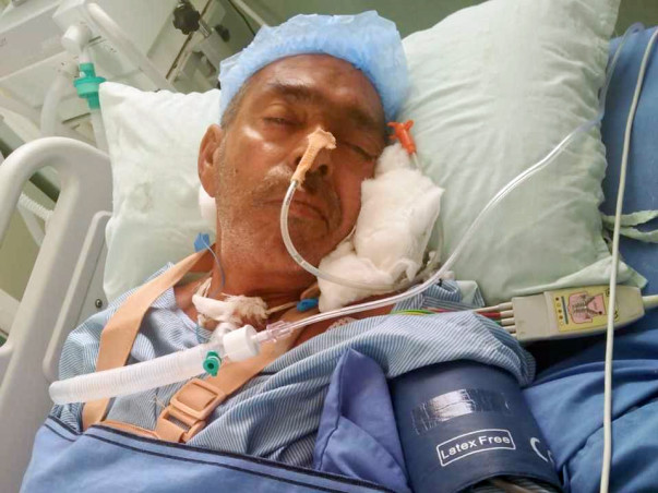 Help My Father Recover from Severe Injuries in Brain and Spinal Cord