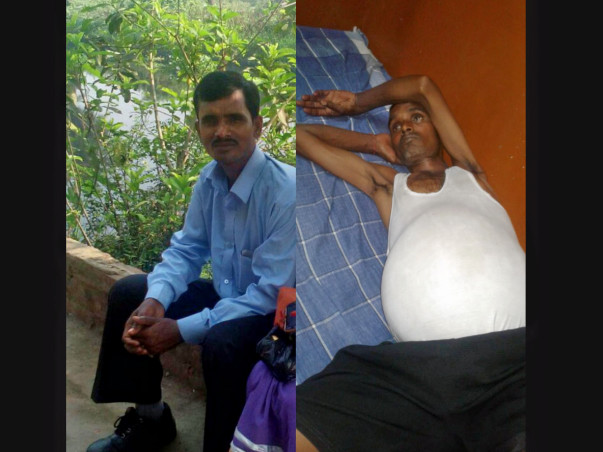 Help Mukhesh Undergo Liver Transplant