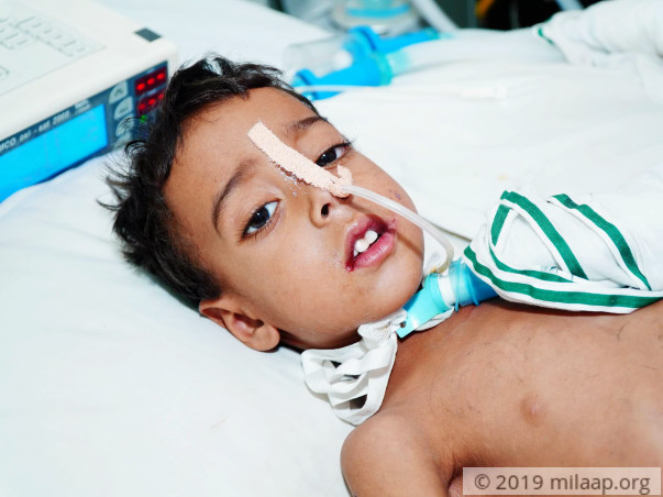 Help Bhageerath Fight Pneumonia