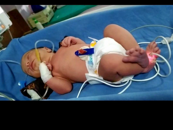 Help Baby of Nitin kumar Fight Prematurity