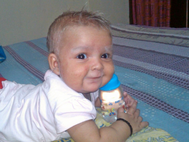 I am fundraising to medical-Financial Help