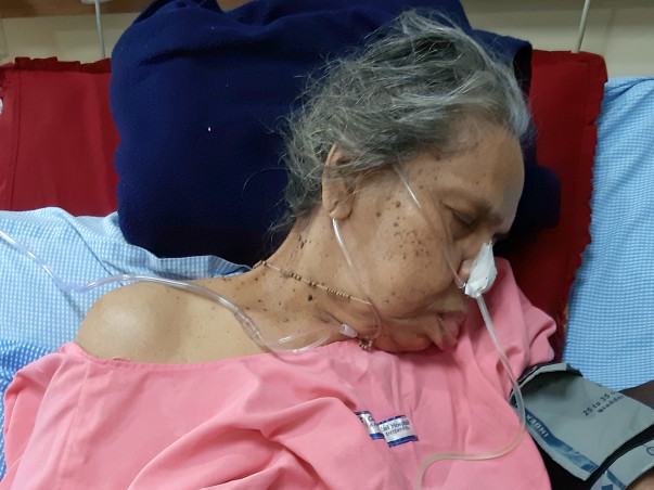 Help My Grandmother Fight Paralysis
