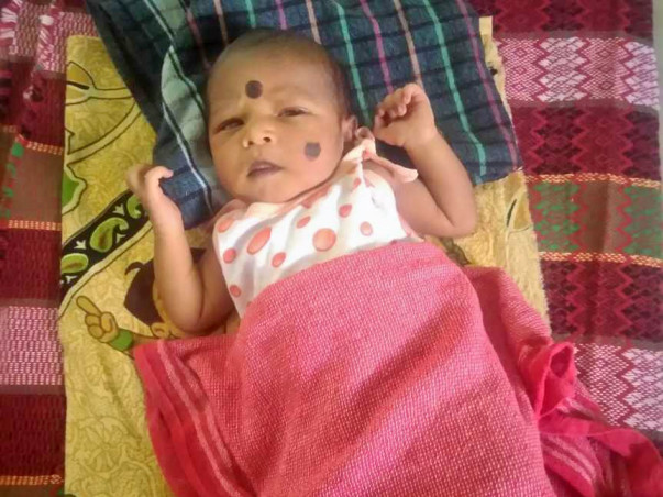 Save 24 Days Old Baby With Heart Complication