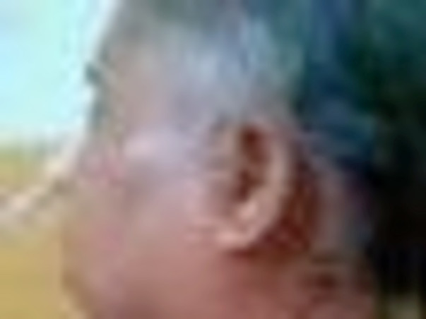 Help My Mother Fight Cancer
