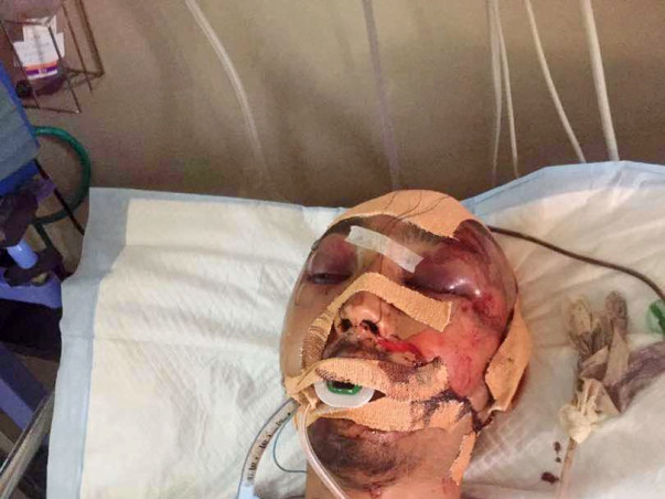 Help Darshan Recover From A Serious Accident