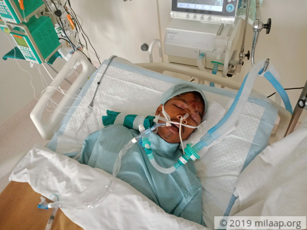Help 19-year-old-Pratik fight in the ICU after a severe road accident