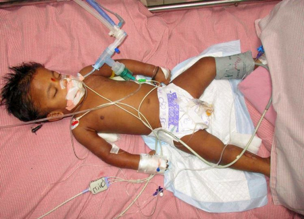 Help my 2-year-old fight Acute Encephalopathy