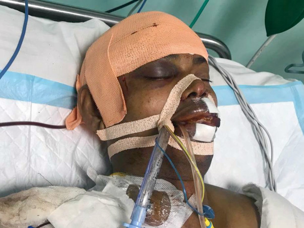 Bobby is looking to support his brain surgery bills