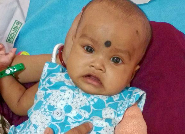Help Us Buy 'Inj Blincyto' The Only Medicine That Can Save My Niece