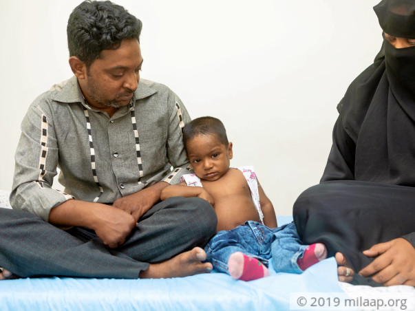 A Rare Disease Has Damaged This 1-Year-Old's Liver, Needs Urgent Help