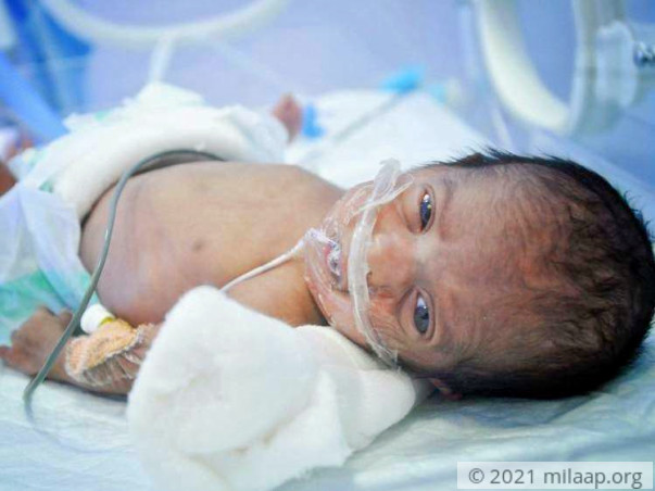 Barber Who Has Not Held His Infant Daughter Even Once Appeals For Help