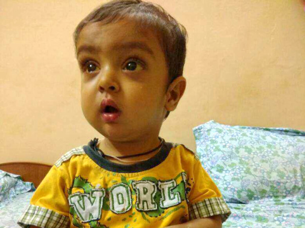 Help Shivansh Undergo a Liver Transplant