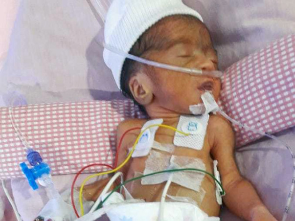 Help Premature Born Roja Fight For Life!