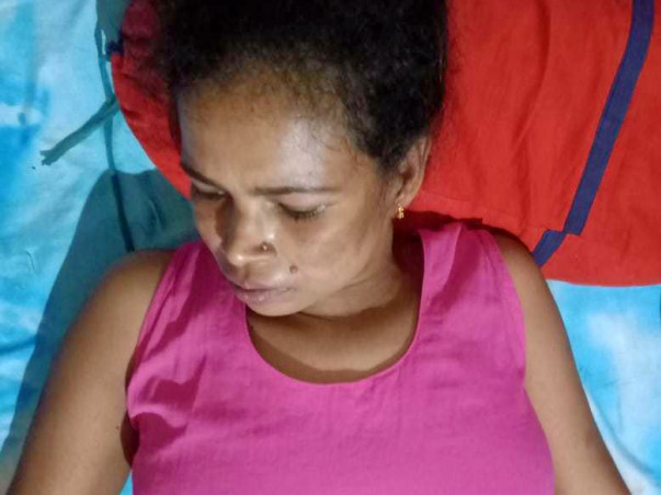Help My Sister Fight Epilepsy