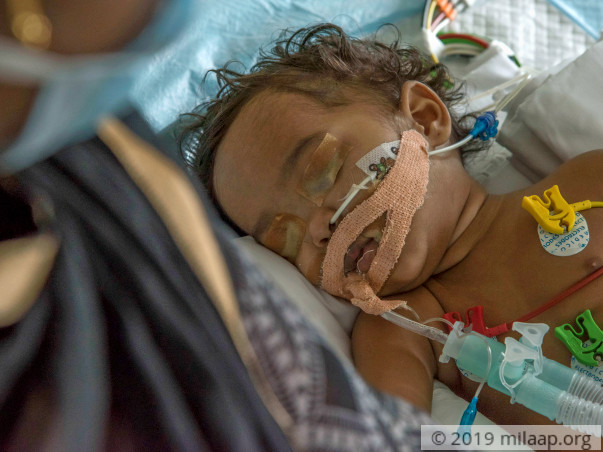 Daily Wager's Only Daughter Struggles To Breathe, Needs Urgent Help