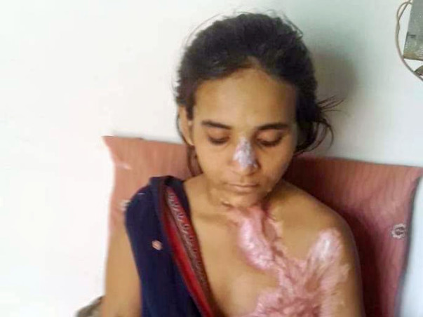 Help khushi fight to live with dignity