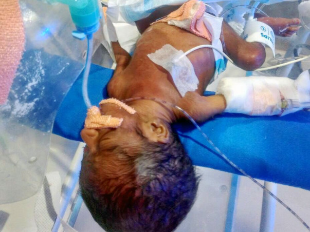 Please Help Newborn Baby in Critical Condition In Hyderabad