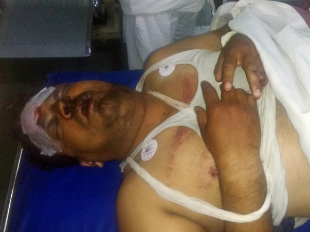 Help Manoj to survive Road Accident