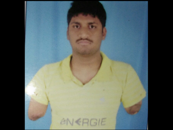 Help Srini To Have His Hands Transplanted