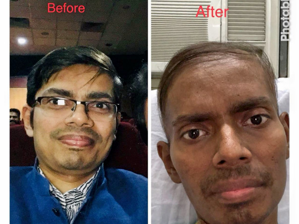 Help Dr. Soumen Fight Blood Cancer.